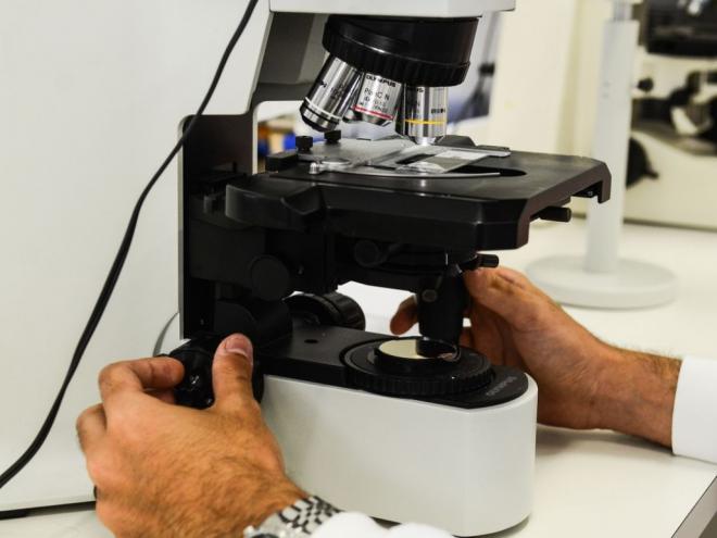 Brasileira desenvolve novo tratamento para câncer de ovário