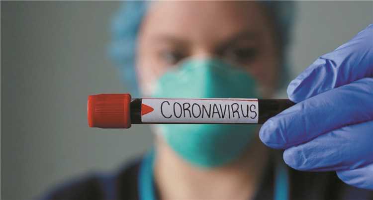 Números oficiais do novo coronavírus (covid-19) no Vale do Aço