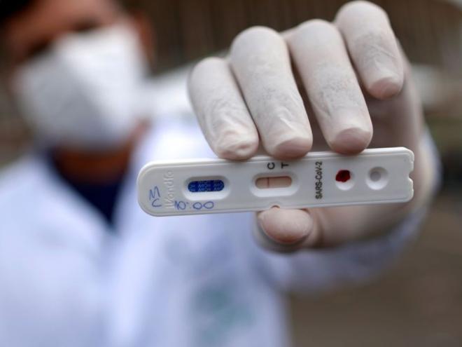 Brasil tem 291.579 casos confirmados de covid-19, 116.683 pessoas recuperadas e 18.859 mortes